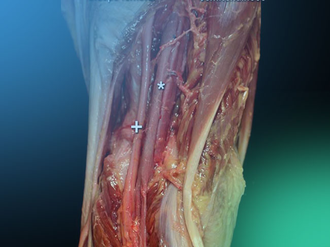 Todo lo que necesitas saber sobre la vascularización de la rodilla.