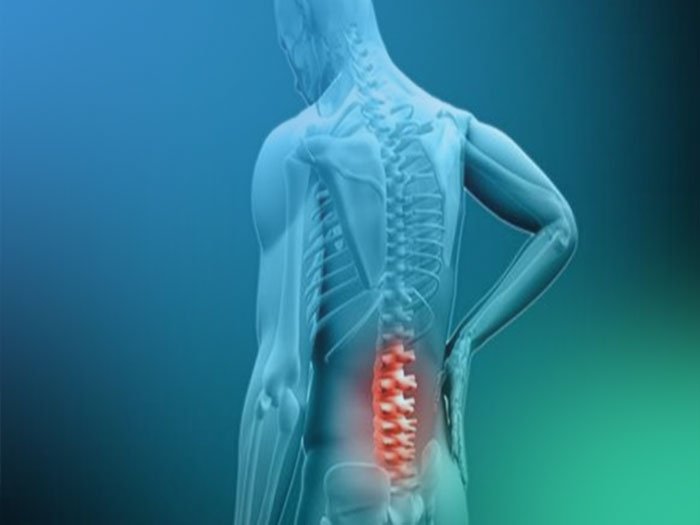 ¿Qué sabes acerca de la Anatomía del Raquis?