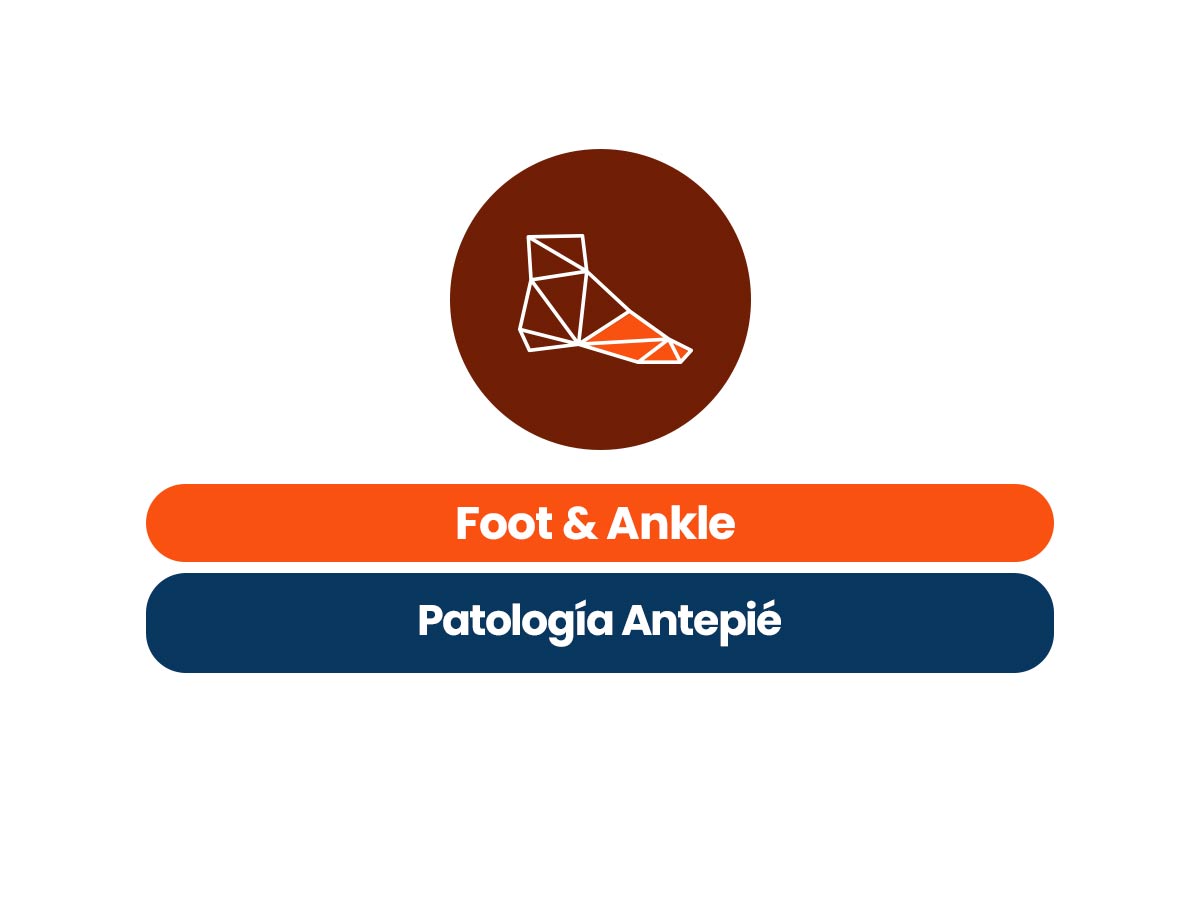 Foot & Ankle Patología de Antepié