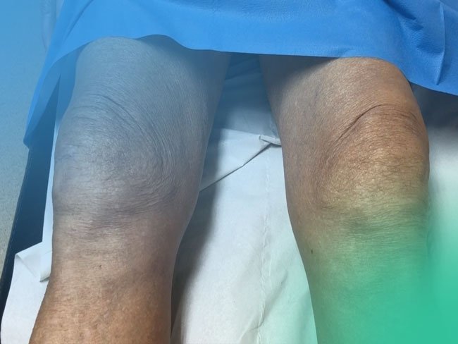 Dolor de rodilla. Aproximación al diagnóstico clínico.