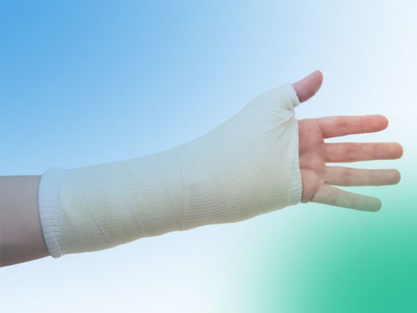 Apuntes básicos de las fracturas de radio distal